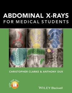 Abdominal X-rays for Medical Students di Christopher Clarke, Anthony Dux edito da John Wiley & Sons Inc