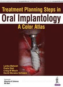 Treatment Planning Steps in Oral Implantology di Lanka Mahesh edito da Jaypee Brothers Medical Publishers Pvt Ltd
