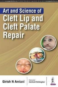 Art and Science of Cleft Lip and Cleft Palate Repair di Girish N. Amlani edito da Jaypee Brothers Medical Publishers Pvt Ltd