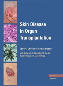 Skin Disease in Organ Transplantation di Clark C. Otley edito da Cambridge University Press