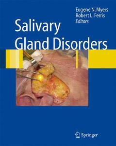 Salivary Gland Disorders edito da Springer Berlin Heidelberg