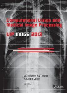 Computational Vision and Medical Image Processing IV edito da Taylor & Francis Ltd