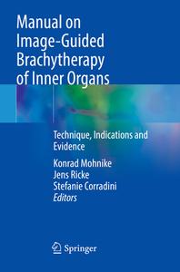 Manual on Image-Guided Brachytherapy of Inner Organs edito da Springer International Publishing