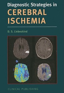 Cerebral Ischemia edito da Clinical Publishing,an imprint of Atlas Medical Publishing L
