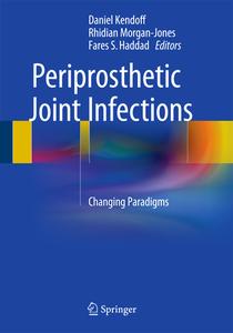 Periprosthetic Joint Infections edito da Springer International Publishing