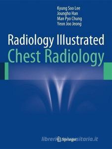 Radiology Illustrated: Chest Radiology di Kyung Soo Lee, Joungho Han, Man Pyo Chung, Yeon Joo Jeong edito da Springer-Verlag GmbH