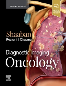 Diagnostic Imaging: Oncology di Akram M. Shaaban edito da Amirsys, Inc