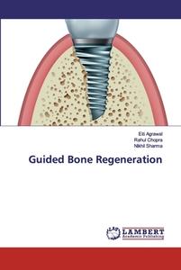 Guided Bone Regeneration di Eiti Agrawal, Rahul Chopra, Nikhil Sharma edito da LAP Lambert Academic Publishing