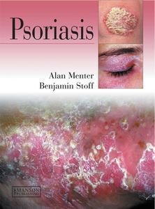 Psoriasis di Alan Menter, Benjamin Stoff edito da Manson Publishing Ltd
