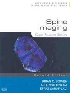 Spine Imaging di Brian C. Bowen, Alfonso Rivera, Efrat Saraf-Lavi edito da Elsevier - Health Sciences Division