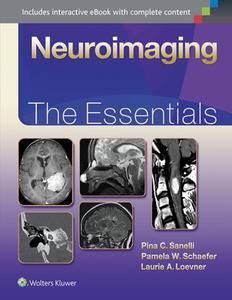 Neuroimaging: The Essentials di Pina Sanelli edito da LWW