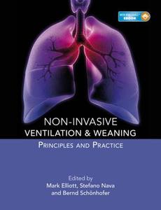 Elliott, M: Non-invasive Ventilation and Weaning: Principles di Mark Elliott edito da Hodder Education Group