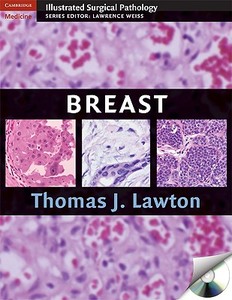 Breast di Thomas J. Lawton edito da Cambridge University Press