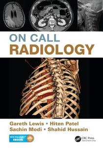 On Call Radiology di Gareth Lewis, Sachin Modi, Hiten Patel, Shahid Hussain edito da Apple Academic Press Inc.