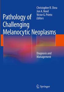 Pathology of Challenging Melanocytic Neoplasms edito da Springer-Verlag New York Inc.