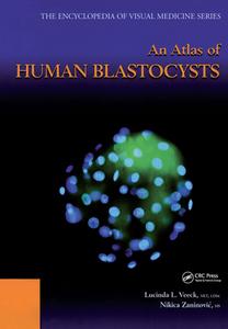 An Atlas Of Human Blastocysts di Lucinda L. Veeck, Nikica Zaninovic edito da Taylor & Francis Ltd