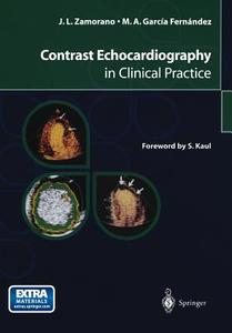 Contrast Echocardiography in Clinical Practice di Miguel A. García Fernández, Jose L. Zamorano edito da Springer Milan