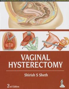Vaginal Hysterectomy di Shirish S. Sheth edito da Jaypee Brothers Medical Publishers Pvt Ltd