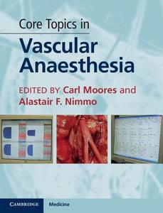 Core Topics in Vascular Anaesthesia di Carl Moores edito da Cambridge University Press