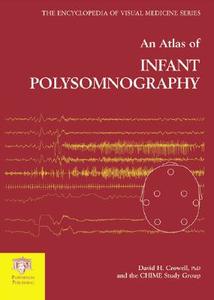 An Atlas Of Infant Polysomnography di #Crowell,  David H. edito da Informa Healthcare