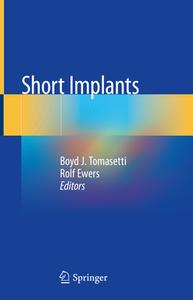 Short Implants edito da Springer International Publishing
