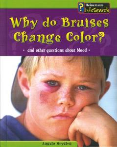 Why Do Bruises Change Color?: And Other Questions about Blood di Angela Royston edito da Heinemann Library