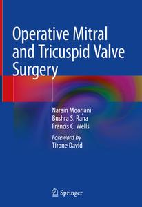 Operative Mitral and Tricuspid Valve Surgery di Narain Moorjani, Bushra S. Rana, Francis C. Wells edito da Springer-Verlag GmbH