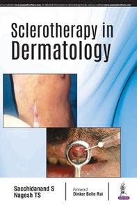 Sclerotherapy in Dermatology di Sacchidanand S edito da Jaypee Brothers Medical Publishers Pvt Ltd