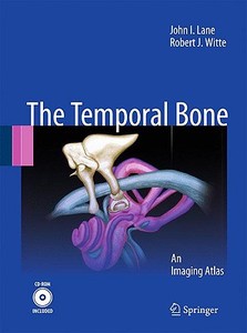 Temporal Bone di John I. Lane, Robert J. Witte edito da Springer-Verlag GmbH