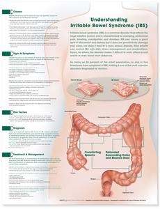 Understanding Irritable Bowel Syndrome Anatomical Chart edito da Lippincott Williams And Wilkins