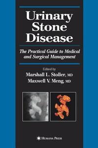 Urinary Stone Disease edito da Humana Press
