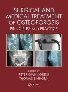 Surgical And Medical Treatment Of Osteoporosis edito da Taylor & Francis Inc