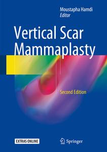 Vertical Scar Mammaplasty edito da Springer-verlag Berlin And Heidelberg Gmbh & Co. Kg