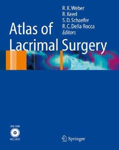 Atlas of Lacrimal Surgery edito da Springer-Verlag GmbH