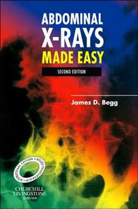 Abdominal X-rays Made Easy di Dr. James D. Begg edito da Elsevier Health Sciences