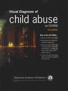 Visual Diagnosis Of Child Abuse di Deborah Lowen, Robert M. Reece, AAP - American Academy of Pediatrics edito da American Academy Of Pediatrics