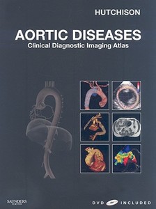 Aortic Diseases di Stuart J. Hutchison edito da Elsevier - Health Sciences Division