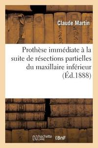 Proth se Imm diate La Suite de R sections Partielles Du Maxillaire Inf rieur di Martin-C edito da Hachette Livre - BNF