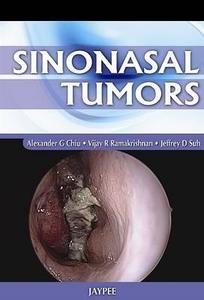 Sinonasal Tumors di Alexander G. Chiu edito da Jaypee Brothers Medical Publishers Pvt Ltd