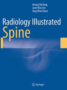 Radiology Illustrated: Spine di Heung Sik Kang, Joon Woo Lee, Jong Won Kwon edito da Springer-verlag Berlin And Heidelberg Gmbh & Co. Kg