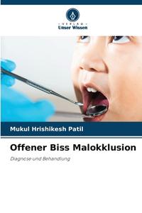 Offener Biss Malokklusion di Mukul Hrishikesh Patil edito da Verlag Unser Wissen