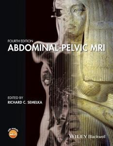 Abdominal-Pelvic MRI di Richard C. Semelka edito da Wiley-Blackwell
