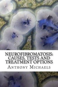 Neurofibromatosis: Causes, Tests and Treatment Options di Anthony S. Michaels Ma edito da Createspace