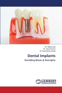 Dental Implants di Dr Geeta Arya, Dr Varun Kumar, Dr Shambhavi Shukla edito da Lap Lambert Academic Publishing