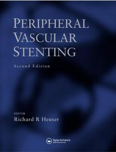 Peripheral Vascular Stenting, Second Edition di Raymond Bonnett, Heuser R. Heuser edito da Taylor & Francis Ltd