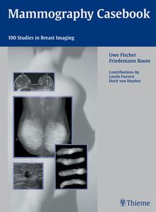 Mammography Casebook di Uwe Fischer edito da Thieme Publishing Group
