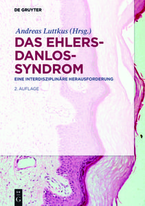 Das Ehlers-Danlos-Syndrom edito da Gruyter, Walter de GmbH