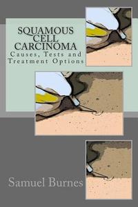 Squamous Cell Carcinoma: Causes, Tests and Treatment Options di Samuel Burnes Ma edito da Createspace