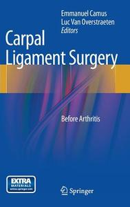 Carpal Ligament Surgery edito da Springer-Verlag GmbH