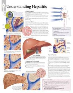 Understanding Hepatitis Laminated Poster di Scientific Publishing edito da Scientific Publishing Limited